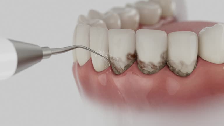 Trusted Invisalign Clear Aligners service in Park River, ND - Dentist Open Now